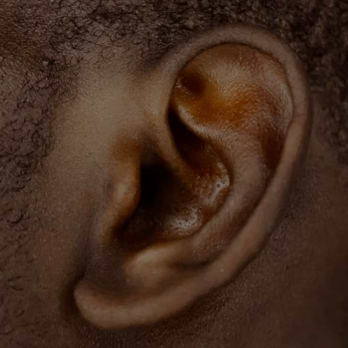 Most Common Types of Hearing Loss Sensorineural, Conductive and Mixed